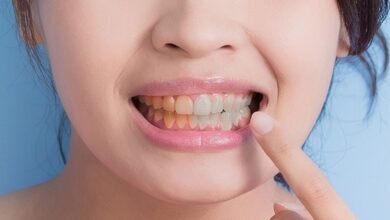 How To Remove Brown Stains From Teeth Naturally